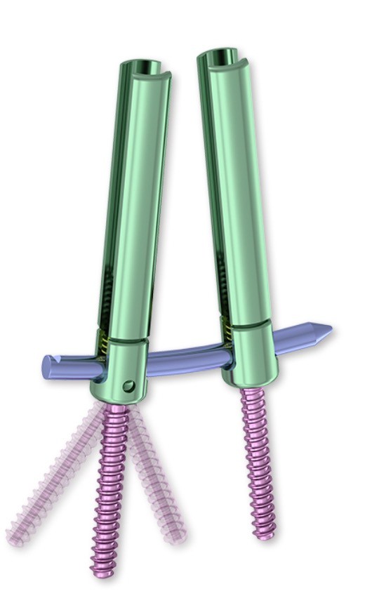 Minimally Invasive Spine System-Monoaxial Screw