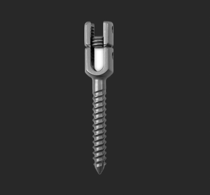 Monoaxial Reduction Pedicle Screw