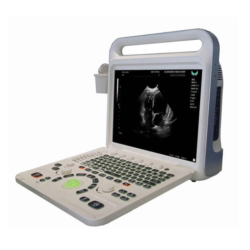 color doppler digital ultrasonic machine